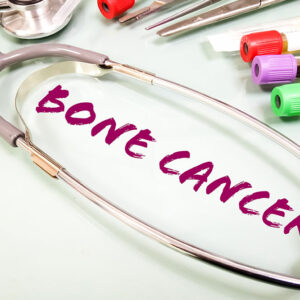 7 warning signs of bone cancer to be aware of